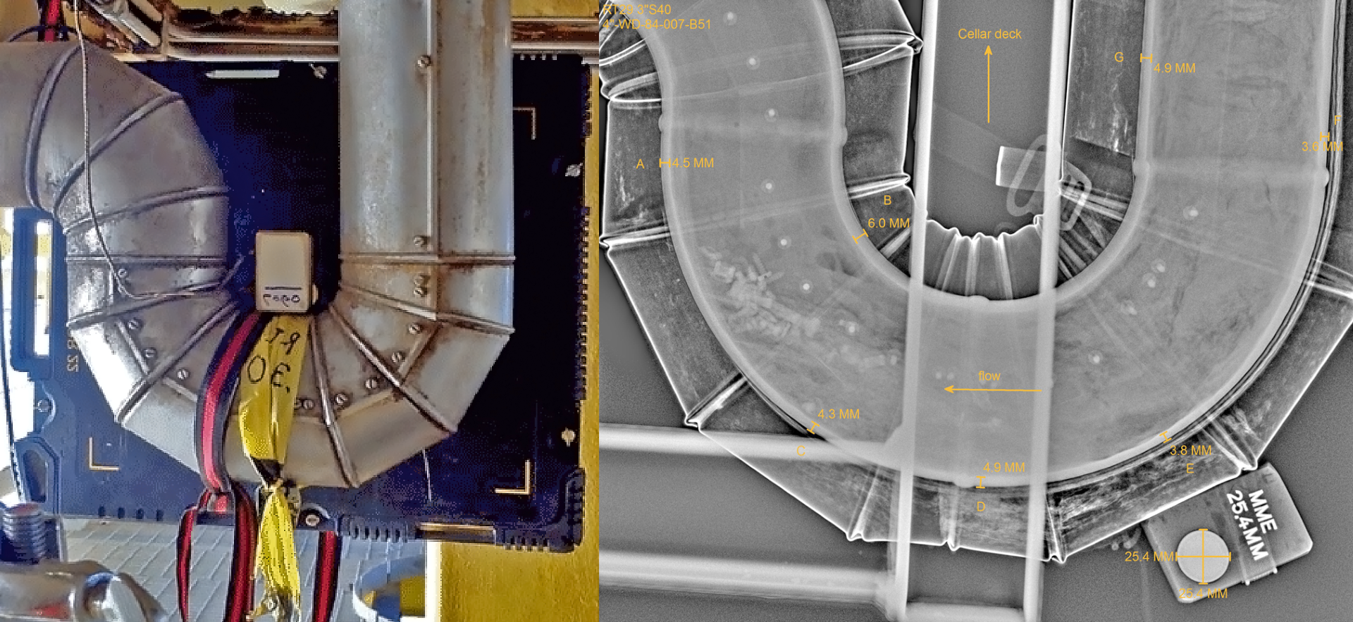 Digital Radiography (DR)